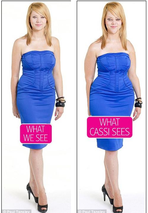 co gai tu nhan "xau het phan thien ha", suyt cat thit cho do beo nhung su that ngo ngang - 4