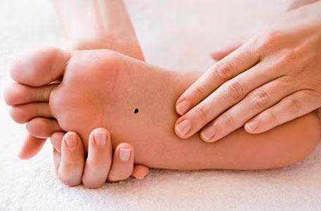 5 nốt ruồi cát tường, ai sở hữu cả đời không lo cơm áo gạo tiền ảnh 1