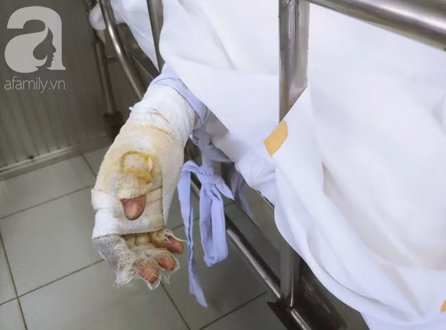 Vụ người phụ nữ nghi dùng xăng đốt chồng rồi tự thiêu: Người chồng liên tục gọi vợ trong phòng săn sóc đặc biệt - Ảnh 4.