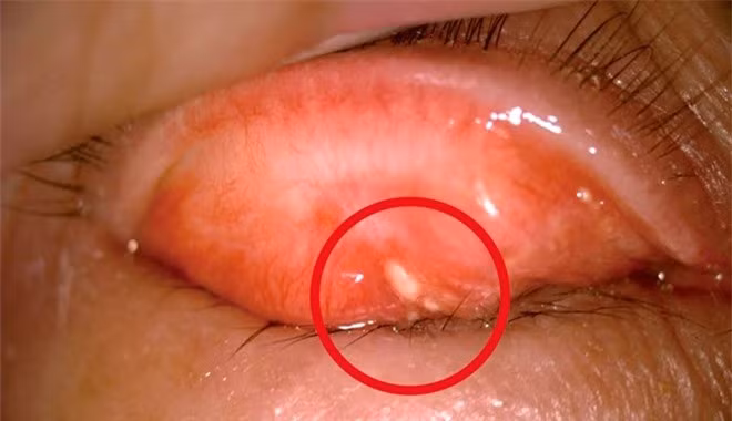 Cô gái Trung Quốc có sỏi trong mắt chỉ vì sở thích mà hội con gái thường làm mỗi ngày - Ảnh 3.