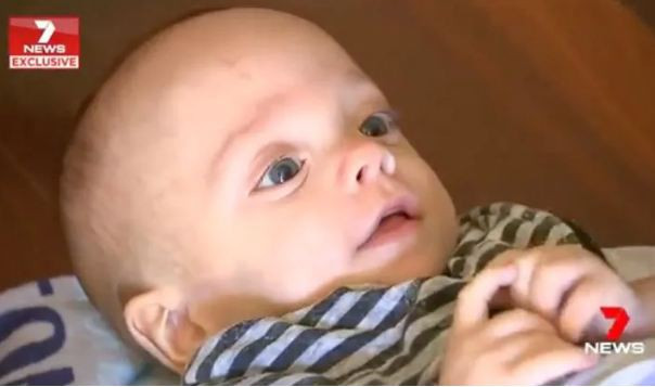 Lạ lùng bé sinh non nhỏ tới mức phải được nuôi trong... túi nhựa để có thể sống sót - Ảnh 3. Lạ lùng bé sinh non nhỏ tới mức phải được nuôi trong... túi nhựa để có thể sống sót - Ảnh 3.