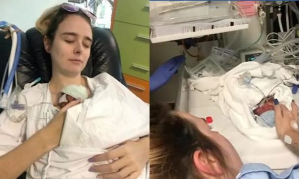 Lạ lùng bé sinh non nhỏ tới mức phải được nuôi trong... túi nhựa để có thể sống sót - Ảnh 2. Lạ lùng bé sinh non nhỏ tới mức phải được nuôi trong... túi nhựa để có thể sống sót - Ảnh 2.