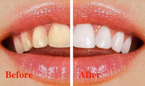 1001 công dụng làm đẹp của chanh, dù là mỹ phẩm tiền triệu cũng không so bì được-7