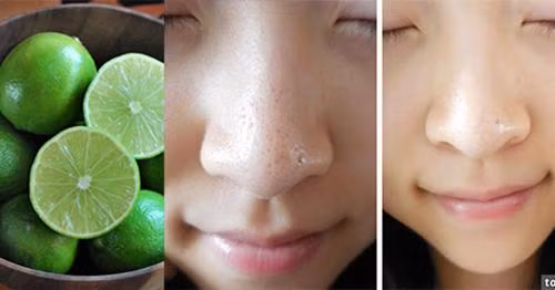 1001 công dụng làm đẹp của chanh, dù là mỹ phẩm tiền triệu cũng không so bì được-1