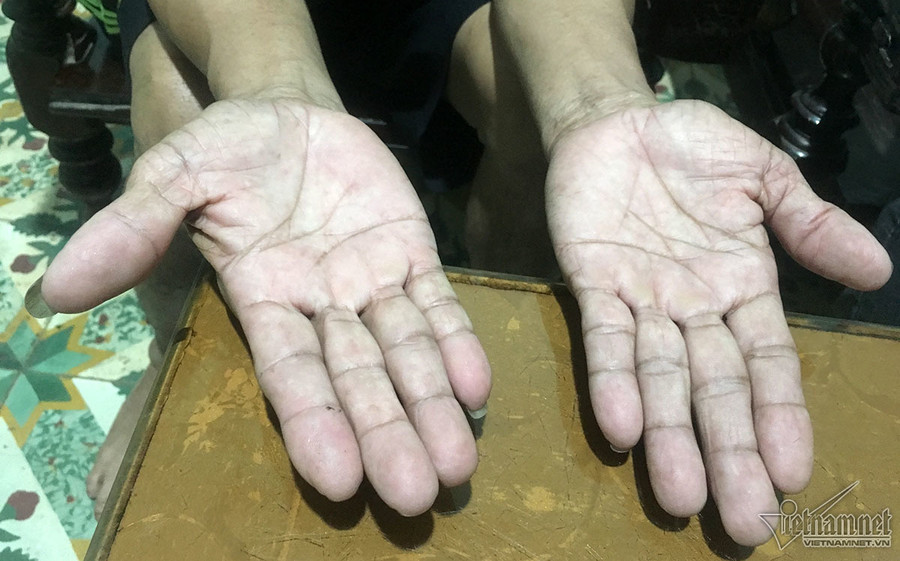 Đôi bàn tay của ông Kim Văn Phong từng ngồi đếm tiền nguyên một ngày không hết. Ảnh: Quốc Huy. Đại gia đá đỏ đếm tiền cả ngày không hết giờ ra sao?