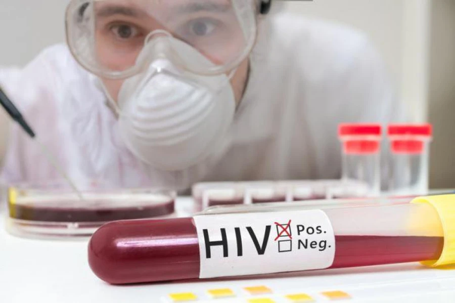 Quy trình xét nghiệm khẳng định nhiễm HIV thế nào?