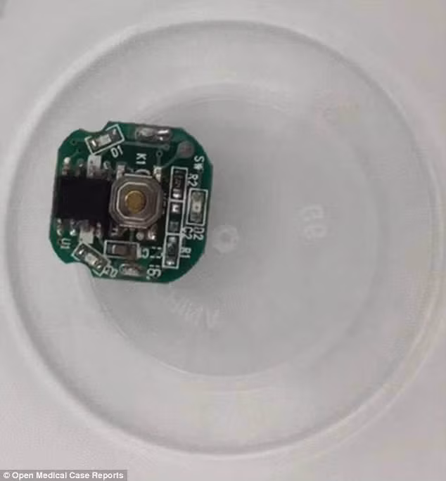 Bé trai 3 tuổi thoát chết ngoạn mục sau khi nuốt bảng điện tử và pin nút từ món đồ chơi quen thuộc của trẻ em ảnh 3