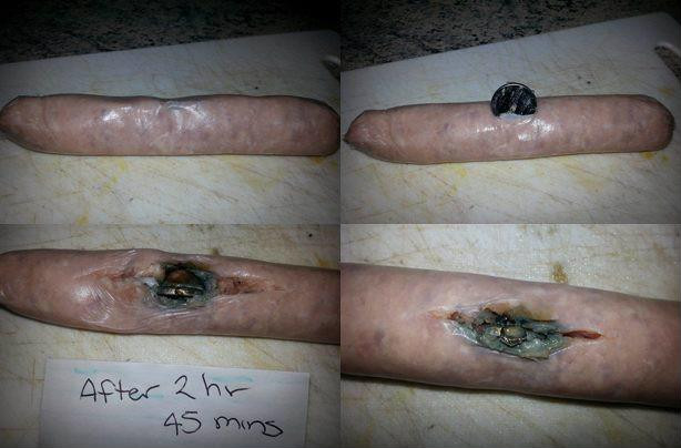 Bé trai 3 tuổi thoát chết ngoạn mục sau khi nuốt bảng điện tử và pin nút từ món đồ chơi quen thuộc của trẻ em ảnh 4