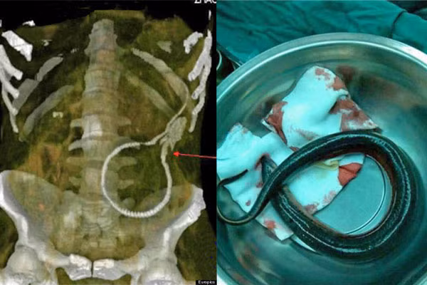 het hon voi nhung sinh vat la trong co the nguoi - 7