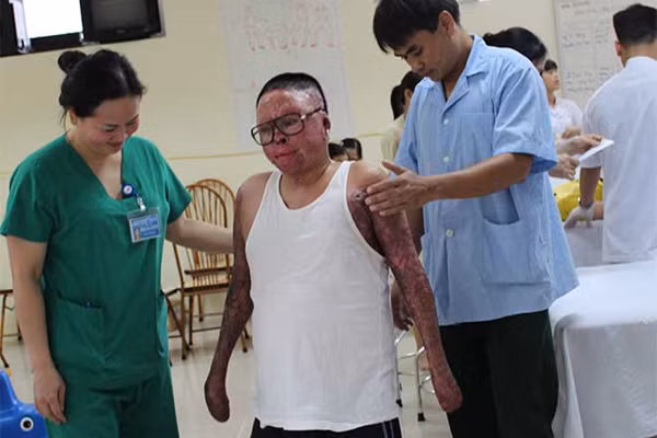 600-ngay-cua-nguoi-duy-nhat-song-sot-vu-may-bay-hoa-lac-1