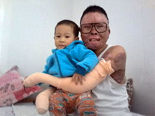 cuoc-song-cua-chien-sy-duy-nhat-song-sot-sau-tai-nan-may-bay-hoa-lac