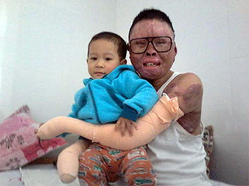 600 ngày của người duy nhất sống sót vụ máy bay Hòa Lạc ảnh 1 cuoc-song-cua-chien-sy-duy-nhat-song-sot-sau-tai-nan-may-bay-hoa-lac