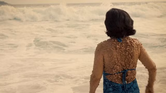 Dù làn da khiếm khuyết, bà mẹ vẫn sẵn sàng diện đồ bơi