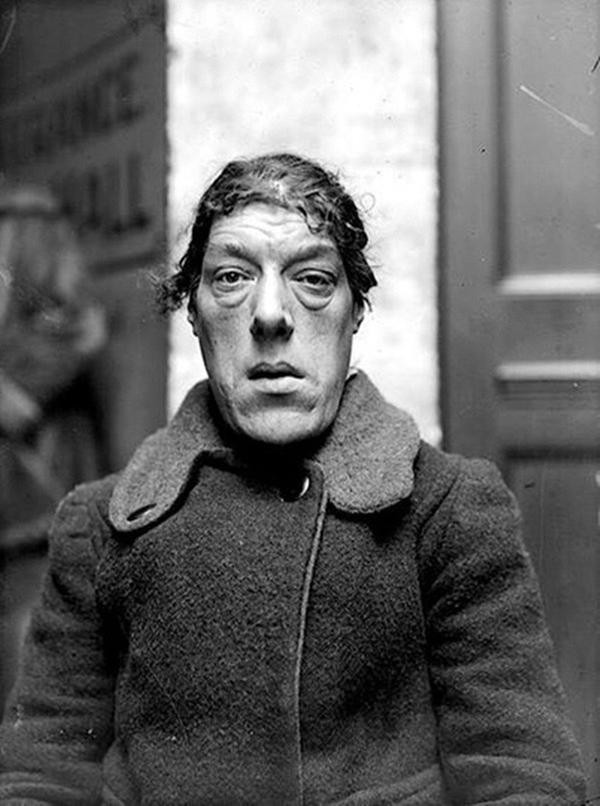 Khó tin người phụ nữ nghèo khó thì xinh đẹp, đến khi xấu xí bỗng dưng... giàu có ảnh 2 khi xinh dep thi ngheo kho, den khi xau xi lai bong choc giau co, khien bao nguoi to mo - 2