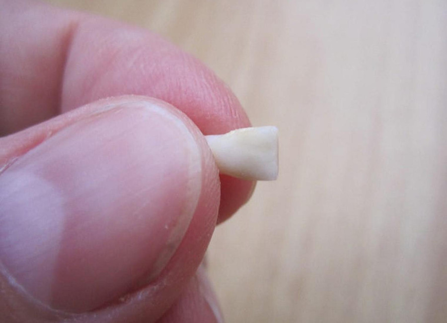 dung voi vut rang sua cua con di vi chung co the &#34;cuu mang&#34; be khi truong thanh - 1