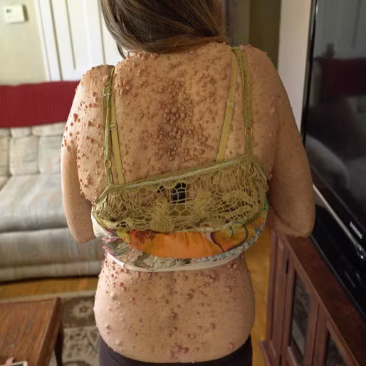 Nhiều người từng chỉ trích và cho rằng Libby mắc bệnh truyền nhiễm