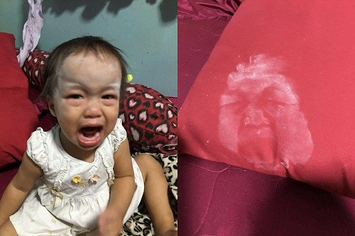 Hậu quả của việc nghịch dại.