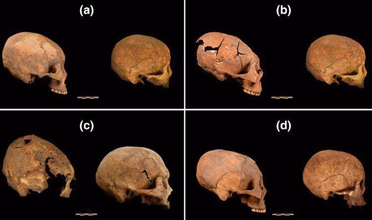 Hộp sọ sửa đổi (nhìn bên trái trong mỗi hộp) so với hộp sọ không thay đổi (Zhang và cộng sự)