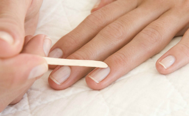 Màu sắc và hình dạng móng tay tiết lộ về sức khỏe. Màu sắc và hình dạng móng tay tiết lộ về sức khỏe.