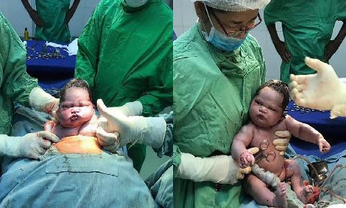 Biểu cảm độc nhất vô nhị của trẻ sơ sinh.