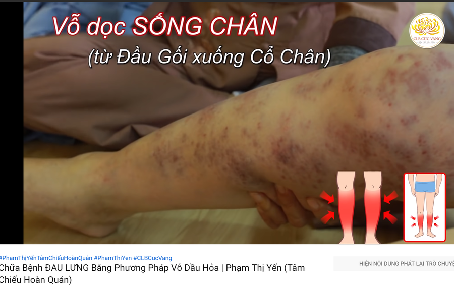 Bác sĩ nói gì phương pháp vỗ dầu hỏa chữa bệnh của cô Yến chùa Ba Vàng? ảnh 2 Keyword đầu tiên có dấu
