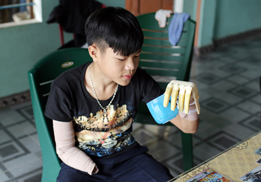 Những ngày đầu mới lắp cánh tay robot, Phan Trọng Hiếu đã có thể tự cầm nắm một số đồ vật với kích thước và trọng lượng khác nhau. Trong ảnh: Hiếu đang tự bê cốc nước để uống.