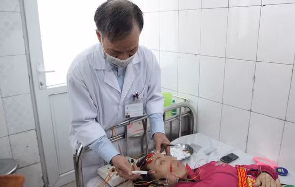 liệt mặt,liệt dây thần kinh số 7,méo miệng,liệt nửa mặt,châm cứu