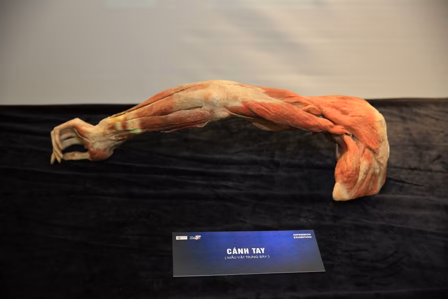 Triển lãm dự kiến trưng bày khoảng 131 mẫu vật cơ thể người thật 