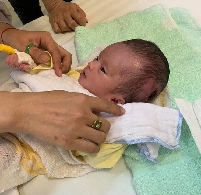 Hình ảnh mới nhất về em bé bị treo ngược trên cành cây suốt 4 ngày ảnh 1 hinh anh moi nhat ve em be bi treo nguoc tren canh cay suot 4 ngay: trang treo, bu bam! - 1