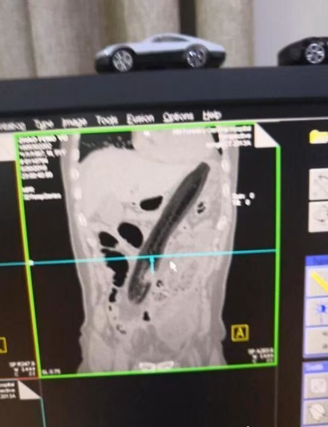 Chỉ vì trái cà dài 30 cm mà người đàn ông trung niên đã suýt nữa mất mạng