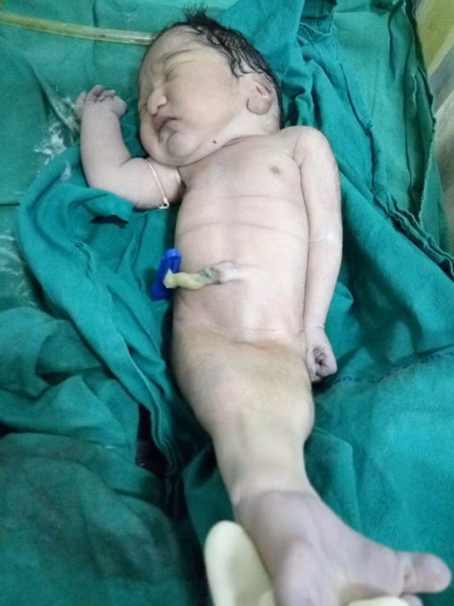 Đứa trẻ tội nghiệp qua đời chỉ 15 phút sau khi sinh