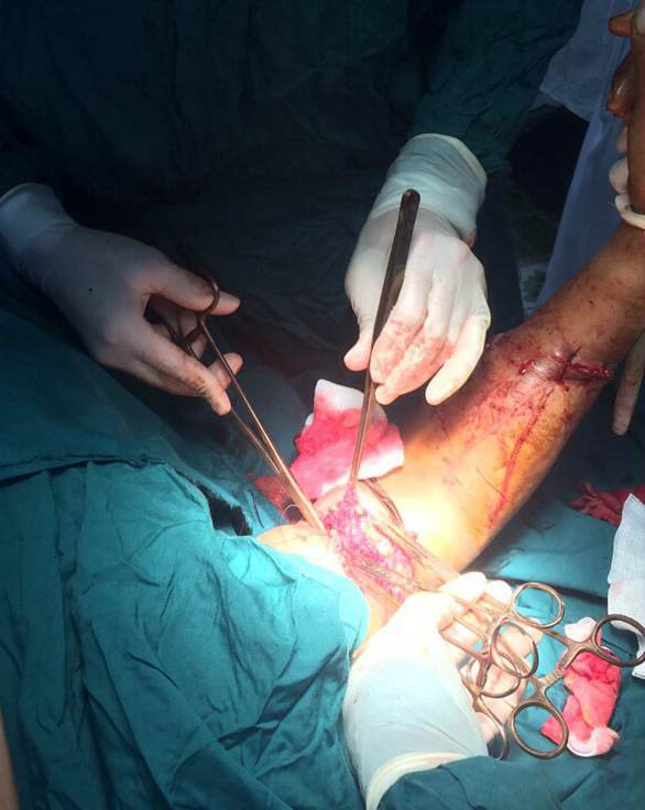 Các y, bác sĩ đang tiến hành phẫu thuật cho ngư dân gặp nạn