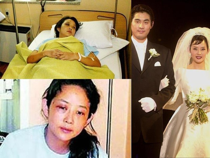 Những minh tinh Hàn Quốc từng bị chồng đánh đến mức phải nhập viện ảnh 3