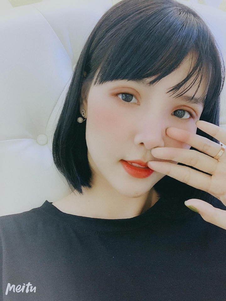 Gương mặt Kỳ Hân bị chê "đơ như cây cơ" sau thẩm mỹ ảnh 5 Tưởng cắt chỉ thẩm mỹ xong sẽ xinh đẹp hơn, ai dè gương mặt Kỳ Hân lại bị chê đơ như cây cơ-5
