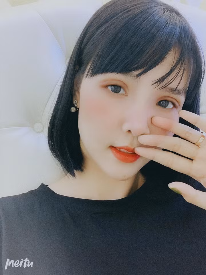 Tưởng cắt chỉ thẩm mỹ xong sẽ xinh đẹp hơn, ai dè gương mặt Kỳ Hân lại bị chê đơ như cây cơ-5