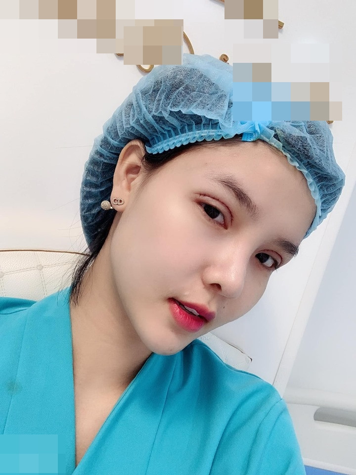Gương mặt Kỳ Hân bị chê "đơ như cây cơ" sau thẩm mỹ ảnh 1 Tưởng cắt chỉ thẩm mỹ xong sẽ xinh đẹp hơn, ai dè gương mặt Kỳ Hân lại bị chê đơ như cây cơ-1