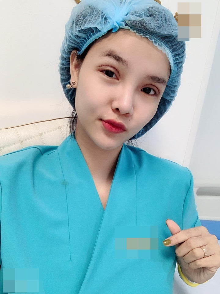 Gương mặt Kỳ Hân bị chê "đơ như cây cơ" sau thẩm mỹ ảnh 2 Tưởng cắt chỉ thẩm mỹ xong sẽ xinh đẹp hơn, ai dè gương mặt Kỳ Hân lại bị chê đơ như cây cơ-2