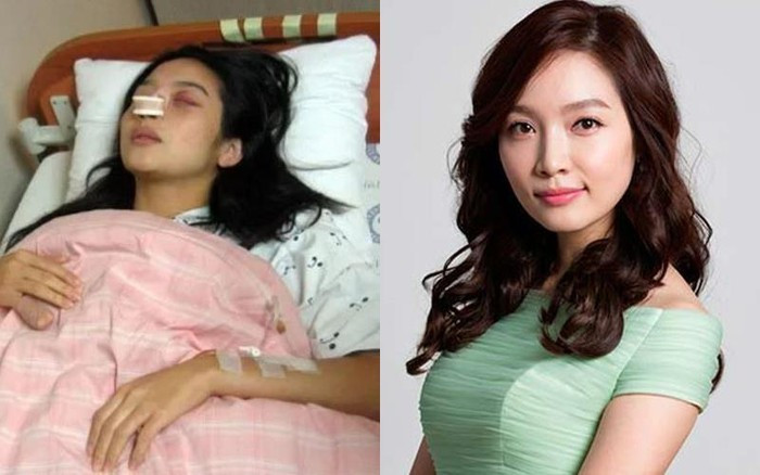 Những minh tinh Hàn Quốc từng bị chồng đánh đến mức phải nhập viện ảnh 2