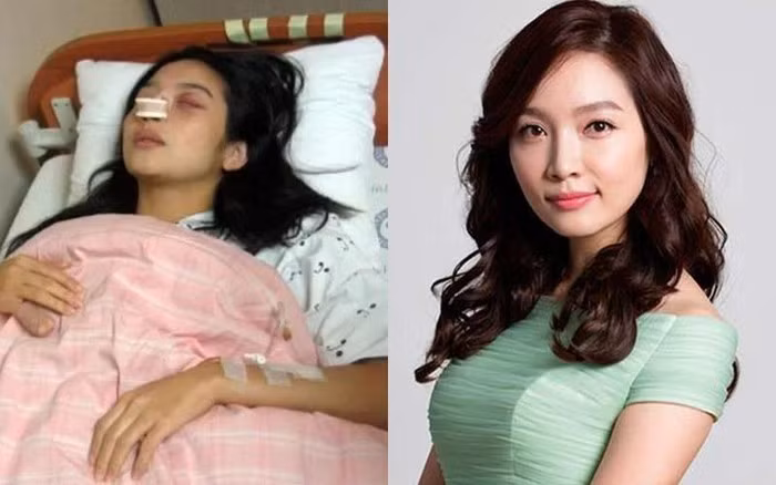 Những minh tinh Hàn Quốc từng bị chồng đánh đến mức phải nhập viện ảnh 2