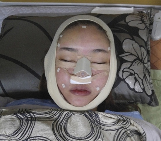 Gương mặt Kỳ Hân bị chê "đơ như cây cơ" sau thẩm mỹ ảnh 11 Tưởng cắt chỉ thẩm mỹ xong sẽ xinh đẹp hơn, ai dè gương mặt Kỳ Hân lại bị chê đơ như cây cơ-11