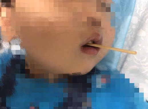 Cậu bé 3 tuổi suýt mất mạng sau khi ăn xúc xích, cha mẹ vạn lần không được cho con vừa ăn vừa làm điều này - Ảnh 1.