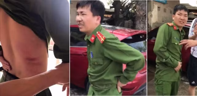 Bỏ chạy sau va chạm giao thông, xe tải đâm bị thương một chiến sĩ công an