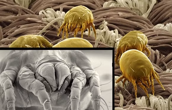 Mạt bụi nhà - kẻ thù gây dị ứng và ăn da chết của chúng ta hàng ngày