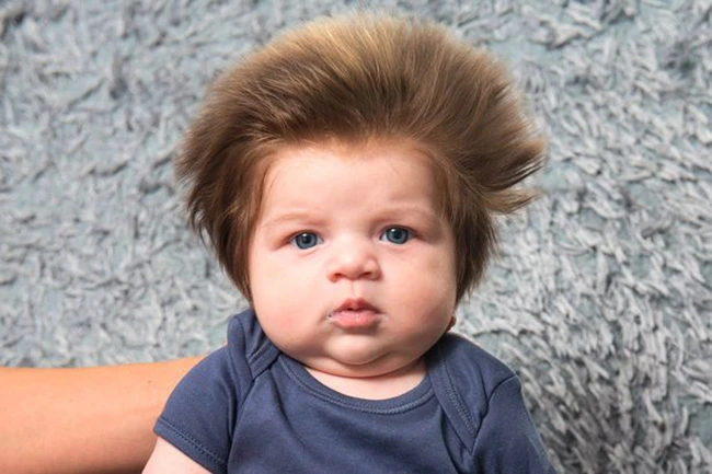 Bé trai 2 tháng tuổi đáng yêu sở hữu mái tóc “điện giật” bẩm sinh