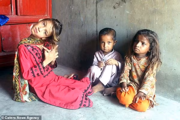 Cô bé sinh ra như bao bạn bè trang lứa, cho đến cú ngã định mệnh hồi 8 tháng tuổi