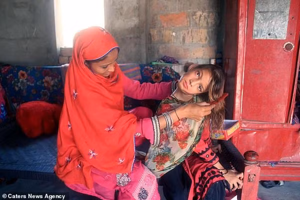 Cô bé đáng yêu không thể tự mình chải đầu, ăn uống, hay đi lại