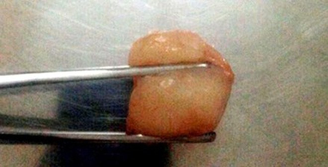 Những lưu ý an toàn khi cho trẻ ăn vải cha mẹ nào cũng cần nhớ - Ảnh 1. Những lưu ý an toàn khi cho trẻ ăn vải cha mẹ nào cũng cần nhớ - Ảnh 1.