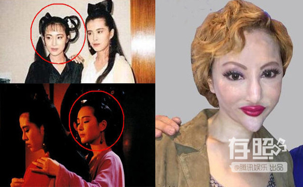 "Thảm họa dao kéo" Tiết Chỉ Luân từng có khuôn mặt rất thanh tú vàtạo thiện cảm cho khán giả - nhất là thời điểm cô đóng "Thiện nữ u hồn". Tuy nhiên, theo thời gian, giờ cô trông quái dị với chiếc mũi khoằm, môi sưng phồng, cằm nhọn hoắt. anh-qua-khu-gay-ngac-nhien-cua-cac-tham-hoa-cbiz-2