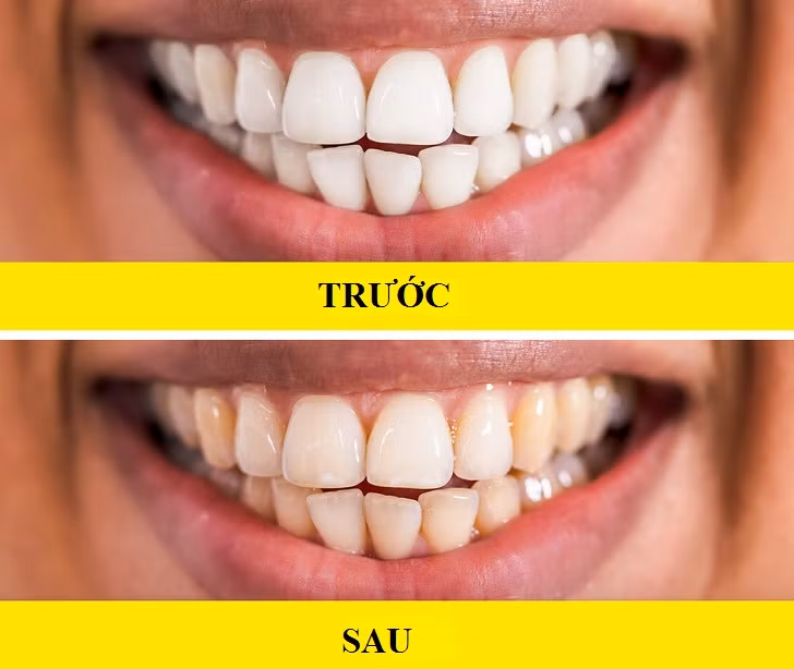 day la nhung dieu bac si khong bao gio noi ra khi ke khang sinh hinh anh 4