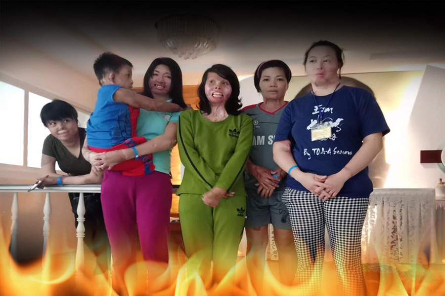 Hai cô gái xinh đẹp bị chồng thiêu sống: Đớn đau tìm lại hình hài tươi sáng - ảnh 7